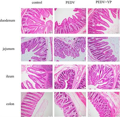 Effect of supplementation with yeast polysaccharides on intestinal function in piglets infected with porcine epidemic diarrhea virus